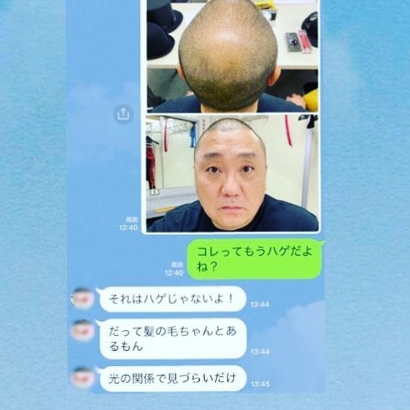 ハゲに優しいミキティ 庄司智春が公開したline画像に男性ファン感動 概要 日刊大衆 芸能 ニュース