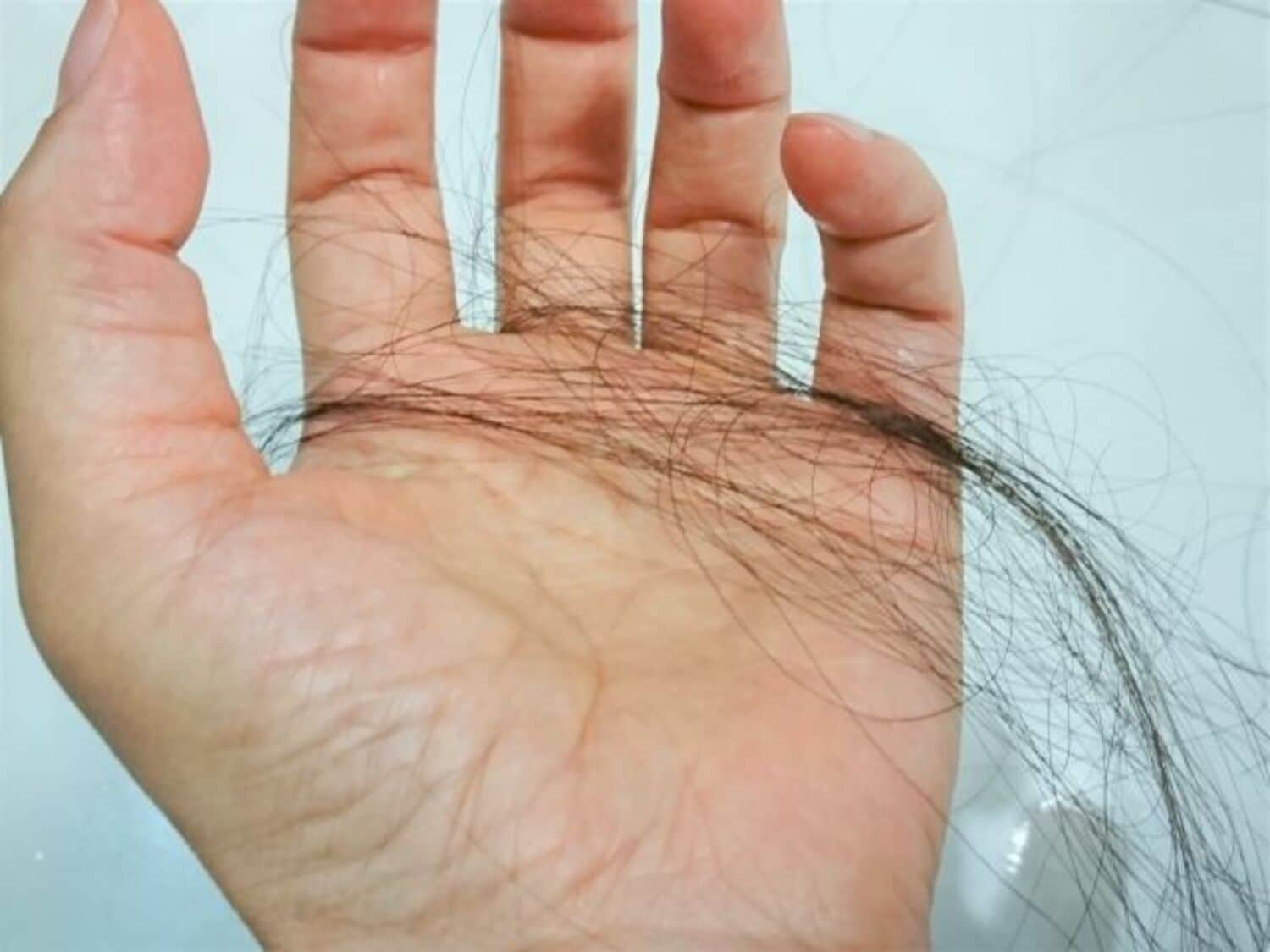 「ハゲ＆薄毛」AGA治療からヘアスタイル術まで徹底対策！の画像