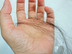 「ハゲ＆薄毛」AGA治療からヘアスタイル術まで徹底対策！