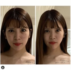 坂口杏里、“整形級”小顔施術のビフォーアフター写真公開もツッコミ相次ぐ「遠近法」「撮り直して」